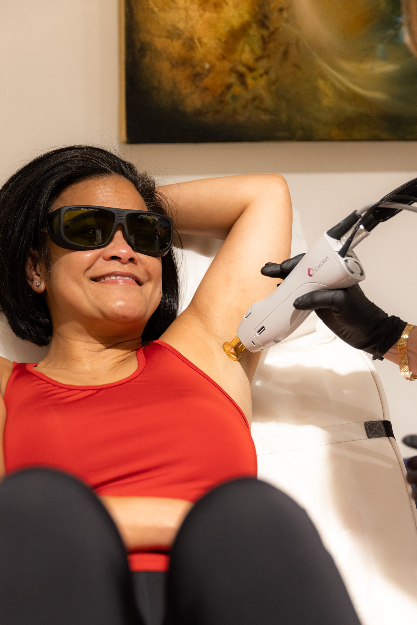 Smiling client receiving underarm laser hair removal treatment at Catara Med Spa in Algonquin, IL.