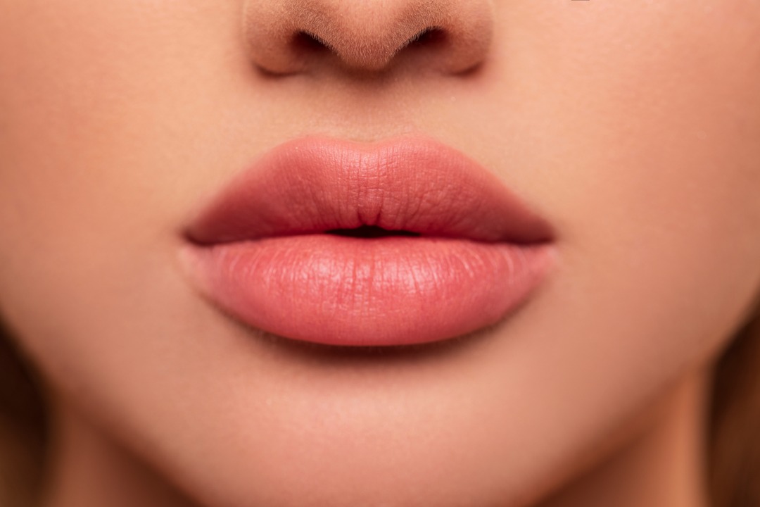 Natural lip filler enhancement at Catara Med Spa in Algonquin IL for fuller, defined lips