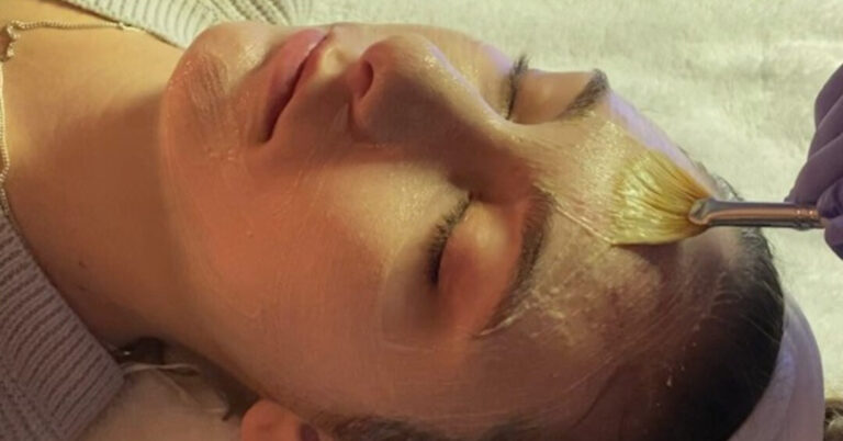 Featured image for Acne Treatments in Algonquin, IL