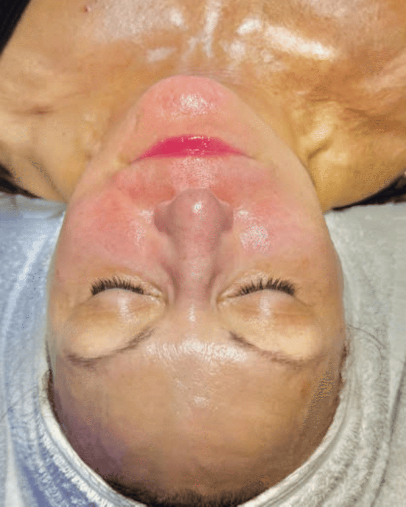 Upside-down close-up of a woman's face with eyes closed, glossy skin from forehead to chin, white cloth wrapped around her head.