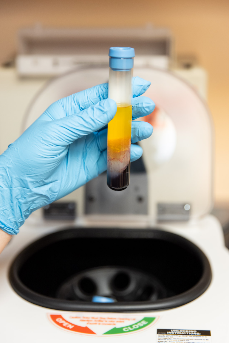 Gloved hand holding a tube of centrifuged blood with amber platelet-rich plasma separated above red cells, in front of a centrifuge.