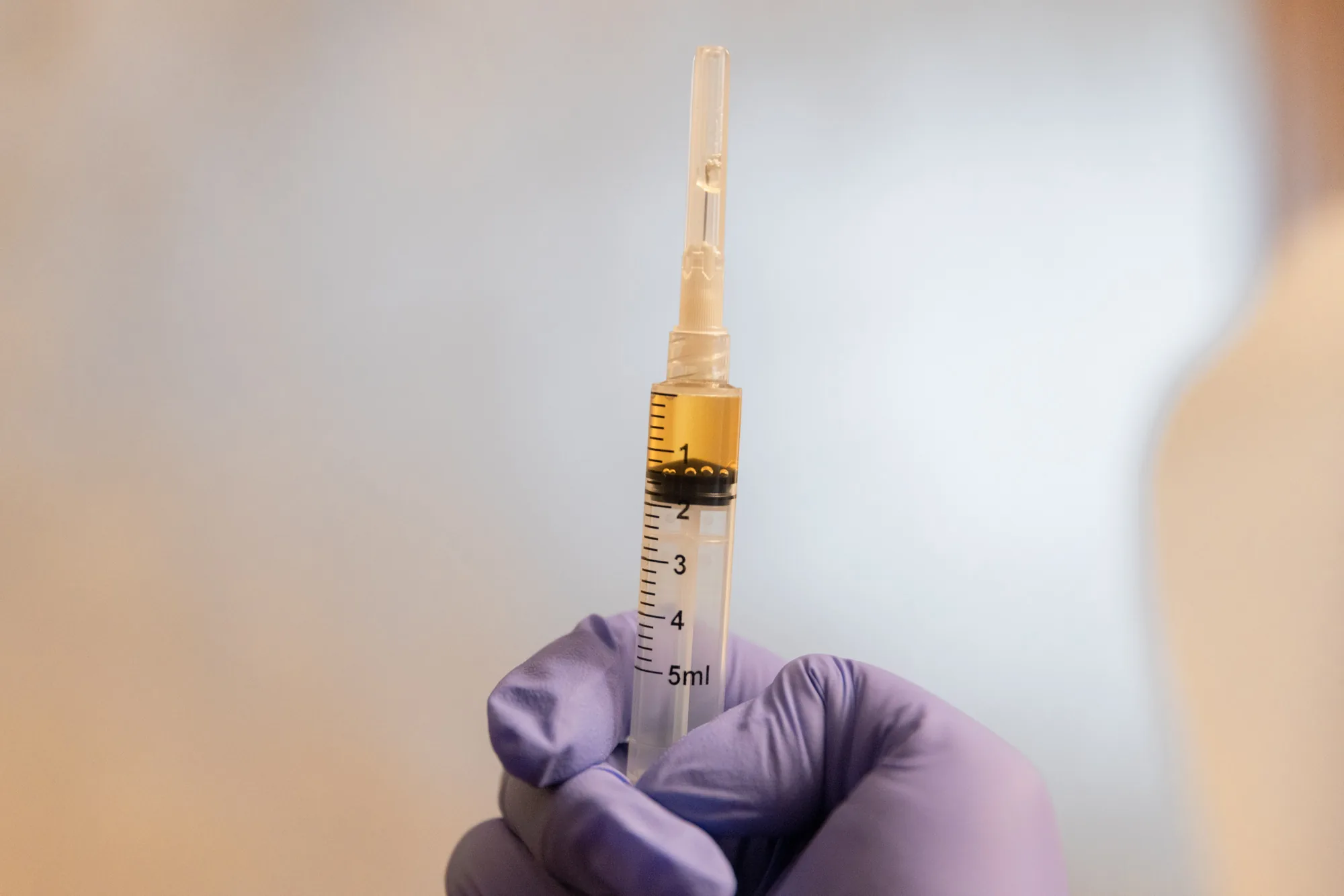 Gloved hand holding a PRP-filled syringe prepared for hair restoration therapy at Catara Med Spa.