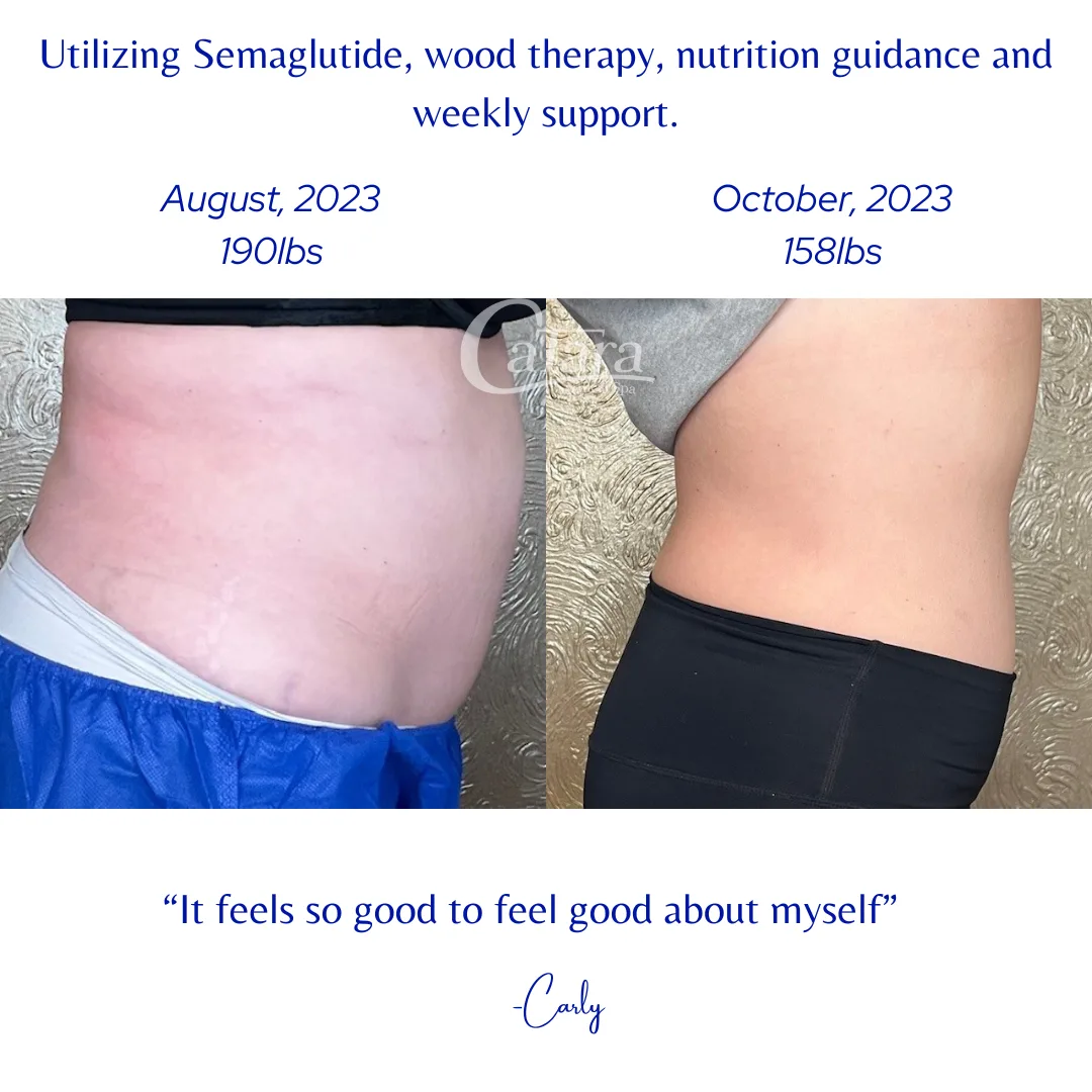 Side by side torso profile before and after comparison headed 'Utilizing Semaglutide, wood therapy, nutrition guidance and weekly support', the left frame captioned 'August, 2023 190lbs' and the right captioned 'October, 2023 158lbs', with the quote 'It feels so good to feel good about myself' below.