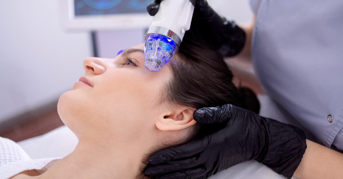 Featured image for “What Is RF Microneedling?”