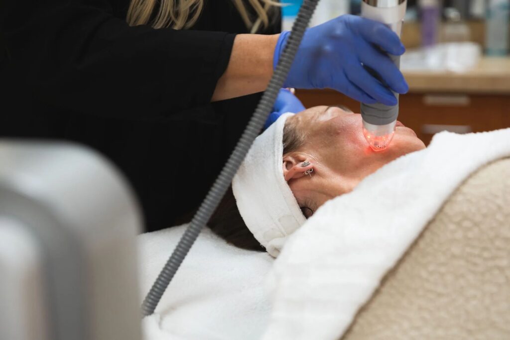 Provider moving a glowing radio frequency handpiece across the cheek and jawline of a reclining client in a spa headband during a non-surgical RF skin tightening session at Catara Med Spa in Algonquin, IL
