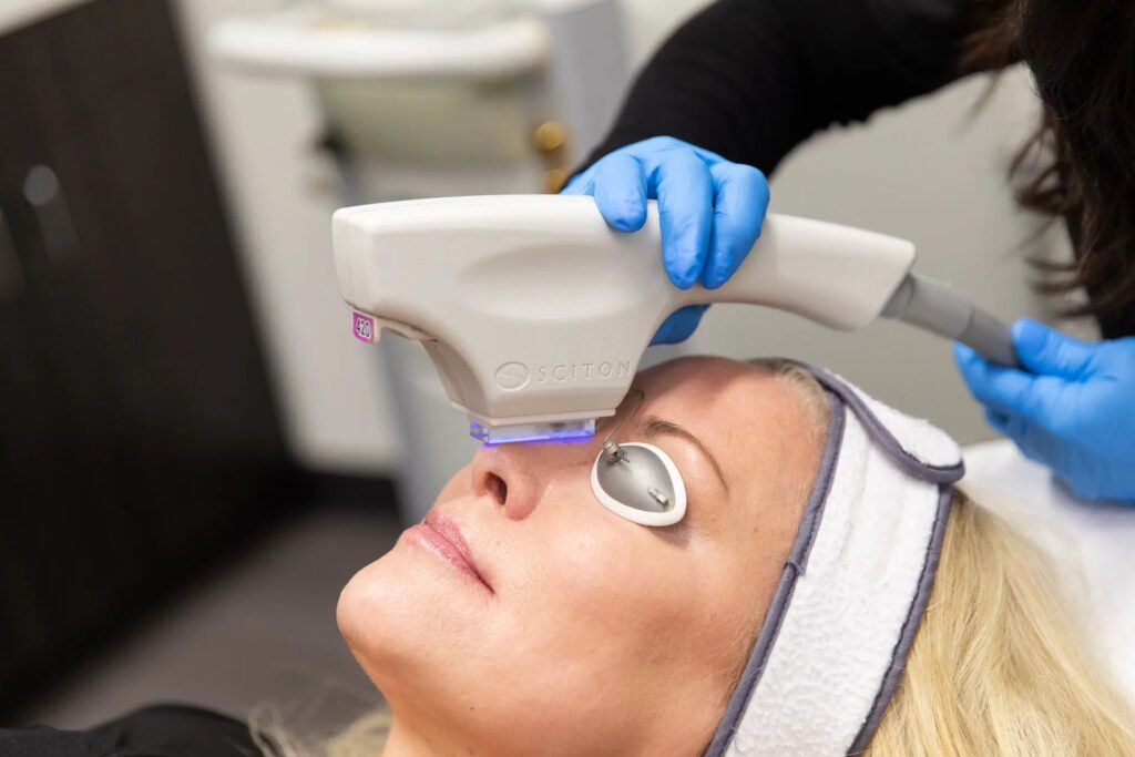 Provider passing a broadband light laser handpiece over the cheek of a reclining client wearing protective eye shields during a rejuvenating and tightening laser facial at Catara Med Spa in Algonquin, IL