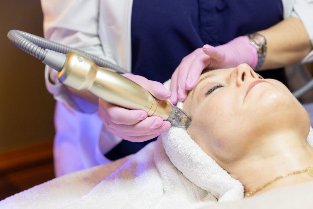 Provider guiding a gold Sylfirm X radiofrequency microneedling handpiece along a reclining client's temple during an RF microneedling treatment for wrinkles, acne scarring and skin laxity at Catara Med Spa in Algonquin, IL