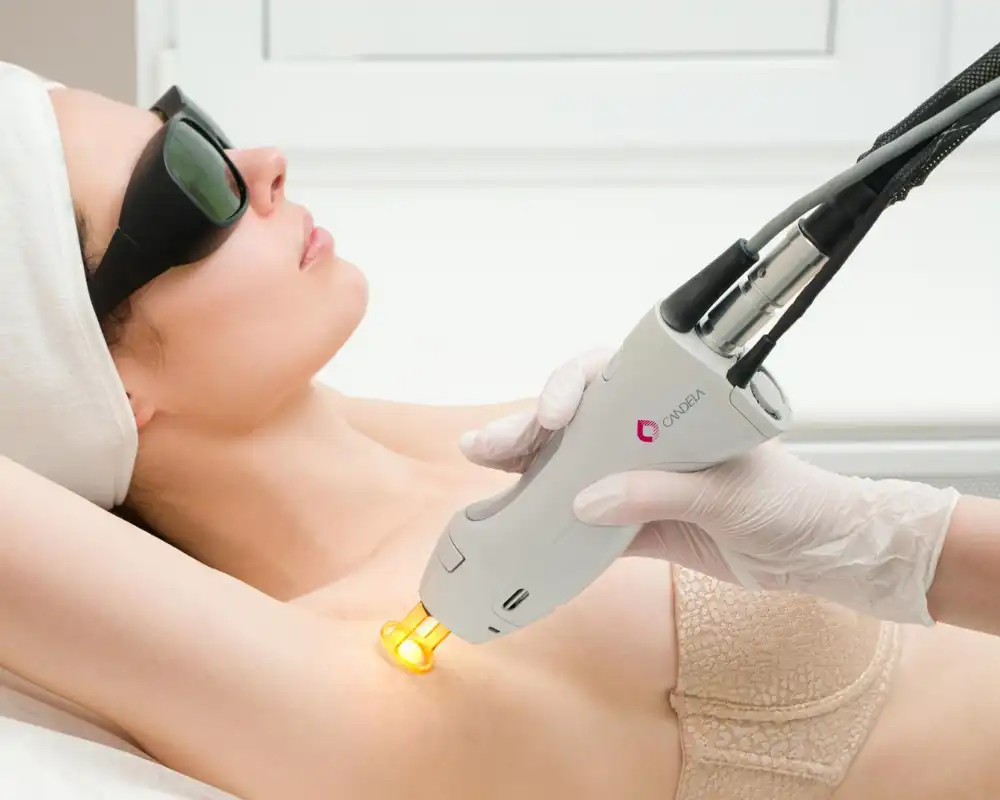Laser hair removal treatment near Crystal Lake, IL at Catara Med Spa